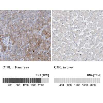 Immunohistochemistry-Paraffin: Chymotrypsin-like protease Antibody [NBP1-87520]
