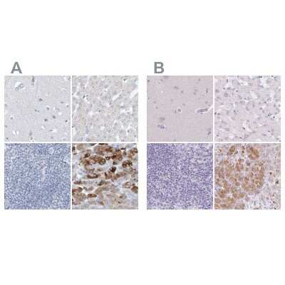 Immunohistochemistry-Paraffin: Chymotrypsin-like protease Antibody [NBP1-87520]