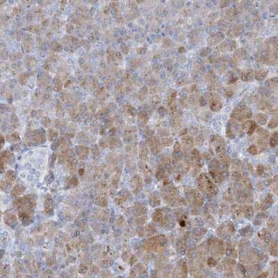 Immunohistochemistry-Paraffin: Chymotrypsin-like protease Antibody [NBP1-87520]