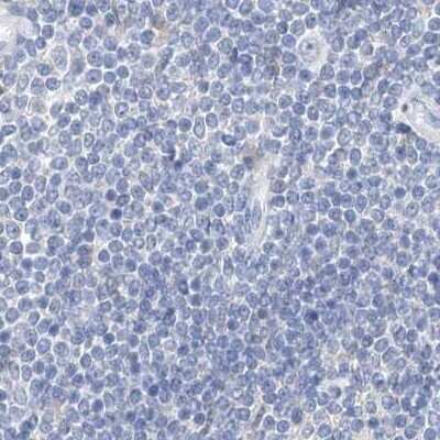 Immunohistochemistry-Paraffin: Chymotrypsin-like protease Antibody [NBP1-87520]