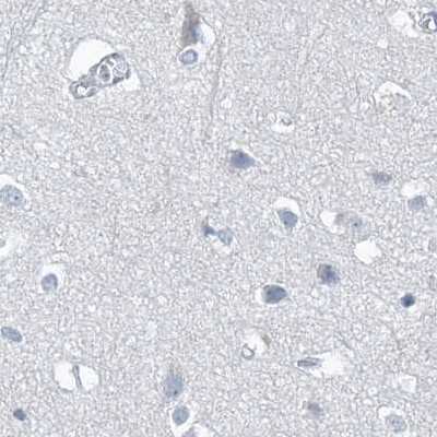 Immunohistochemistry-Paraffin: Chymotrypsin-like protease Antibody [NBP1-87520]