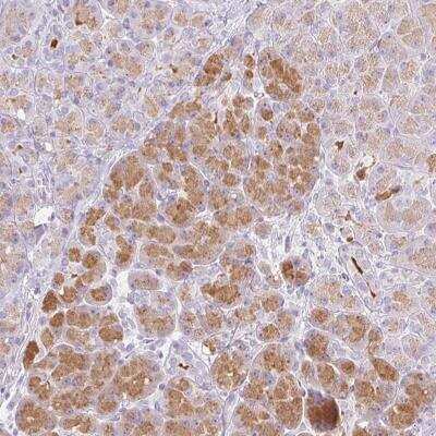 Immunohistochemistry-Paraffin: Chymotrypsin-like protease Antibody [NBP2-33973]