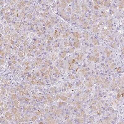 Immunohistochemistry-Paraffin: Chymotrypsin-like protease Antibody [NBP2-33973]