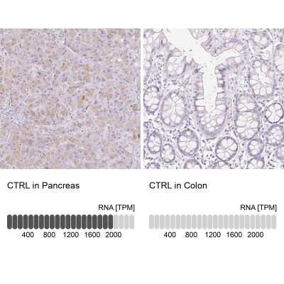 Immunohistochemistry-Paraffin: Chymotrypsin-like protease Antibody [NBP2-33973]