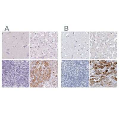 Immunohistochemistry-Paraffin: Chymotrypsin-like protease Antibody [NBP2-33973]