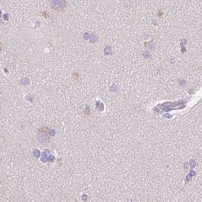 Immunohistochemistry-Paraffin: Chymotrypsin-like protease Antibody [NBP2-33973]