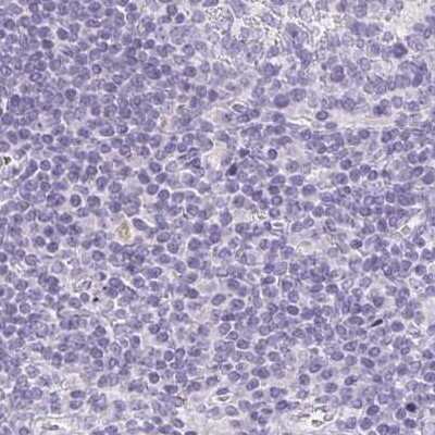 Immunohistochemistry-Paraffin: Chymotrypsin-like protease Antibody [NBP2-33973]