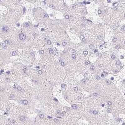 Immunohistochemistry-Paraffin: Chymotrypsin-like protease Antibody [NBP2-33973]