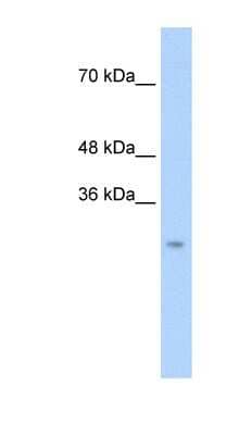 Western Blot: Chymotrypsin-like protease Antibody [NBP1-58002]