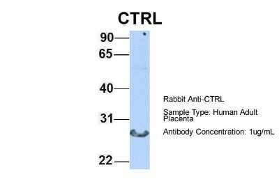 Western Blot: Chymotrypsin-like protease Antibody [NBP1-58056]