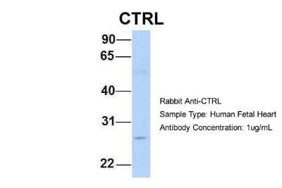 Western Blot: Chymotrypsin-like protease Antibody [NBP1-58056]