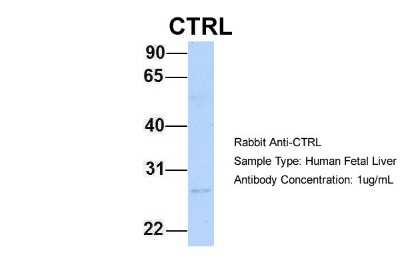 Western Blot: Chymotrypsin-like protease Antibody [NBP1-58056]
