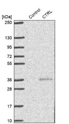 Western Blot: Chymotrypsin-like protease Antibody [NBP1-87520]