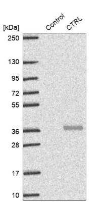 Western Blot: Chymotrypsin-like protease Antibody [NBP2-33973]