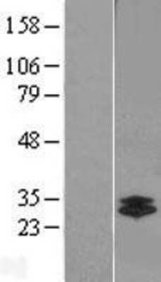 Western Blot: Chymotrypsin-like protease Overexpression Lysate [NBL1-09585]