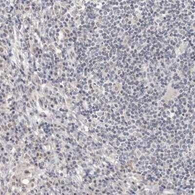 Immunohistochemistry-Paraffin: Cingulin Antibody [NBP1-89601]