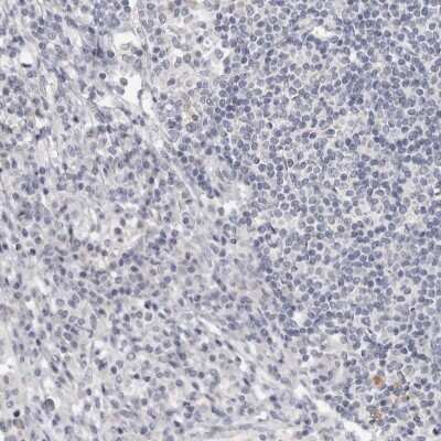 Immunohistochemistry-Paraffin: Cingulin Antibody [NBP1-89602]