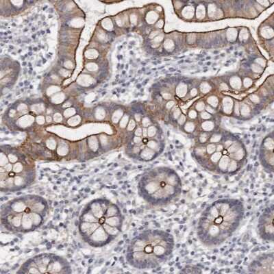 Immunohistochemistry-Paraffin: Cingulin Antibody [NBP1-89602]