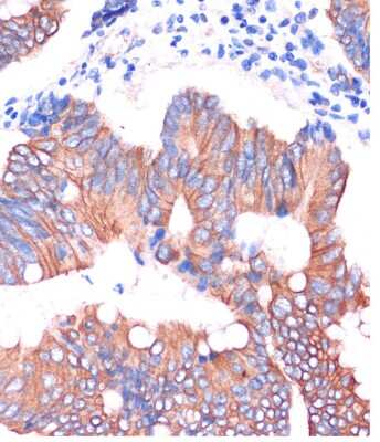 Immunohistochemistry-Paraffin: Cingulin Antibody - Azide and BSA Free [NBP2-92240]