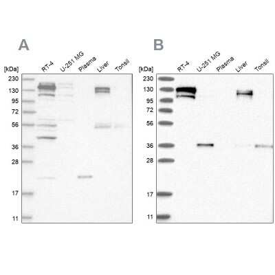 Western Blot: Cingulin Antibody [NBP1-89602]