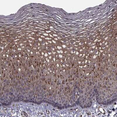 Immunohistochemistry: Cip4 Antibody [NBP2-68940]