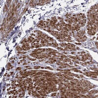 Immunohistochemistry: Cip4 Antibody [NBP2-68971]