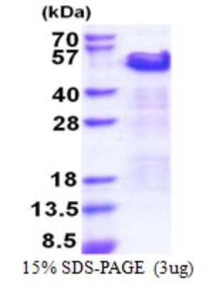 SDS-PAGE: Recombinant Human Cip4 His Protein [NBP2-22864]