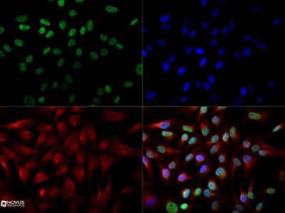 Immunocytochemistry/ Immunofluorescence: Cited-2 Antibody (JA22) - BSA Free [NB100-136]