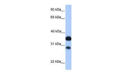 Western Blot: Cited-2 Antibody [NBP2-88786]