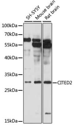 Western Blot: Cited-2 AntibodyAzide and BSA Free [NBP2-92090]