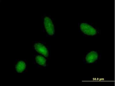 Immunocytochemistry/ Immunofluorescence: Citidine Deaminase Antibody [H00000978-B02P]
