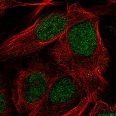 Immunocytochemistry/ Immunofluorescence: Citidine Deaminase Antibody [NBP2-39019]