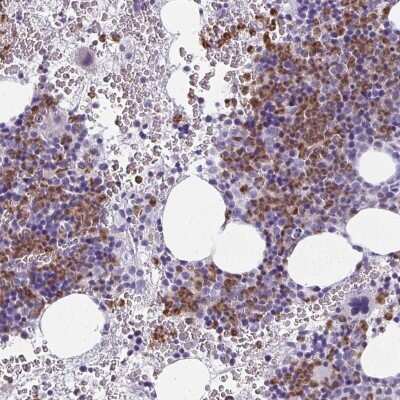 Immunohistochemistry: Citidine Deaminase Antibody [NBP2-39019]