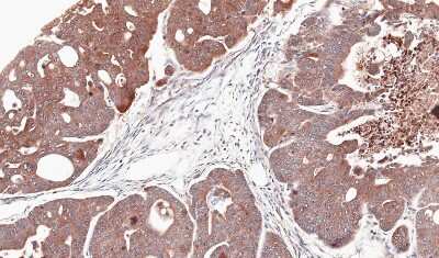 Immunohistochemistry-Paraffin: Citidine Deaminase Antibody [NBP1-31412]