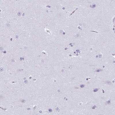 Immunohistochemistry-Paraffin: Citidine Deaminase Antibody [NBP2-39019]