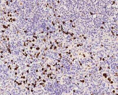 Immunohistochemistry-Paraffin: Citidine Deaminase Antibody [NBP3-12595]