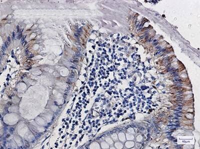 Immunohistochemistry-Paraffin: Citidine Deaminase Antibody (S08-4C9) [NBP3-19948]