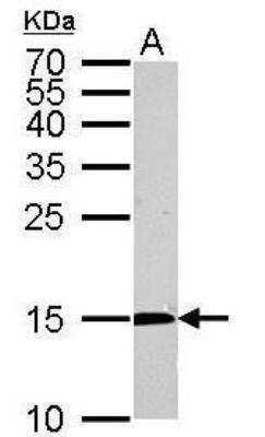 Western Blot: Citidine Deaminase Antibody [NBP1-31412]