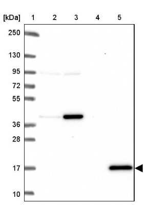 Western Blot: Citidine Deaminase Antibody [NBP2-39019]