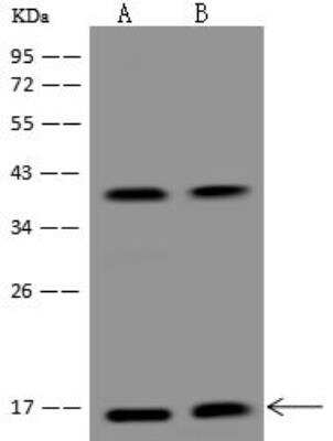 Western Blot: Citidine Deaminase Antibody [NBP3-12595]