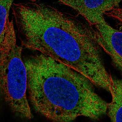 Immunocytochemistry/ Immunofluorescence: Citron Kinase Antibody [NBP2-57994]