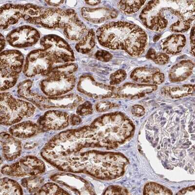 Immunohistochemistry: Citron Kinase Antibody [NBP2-38592]