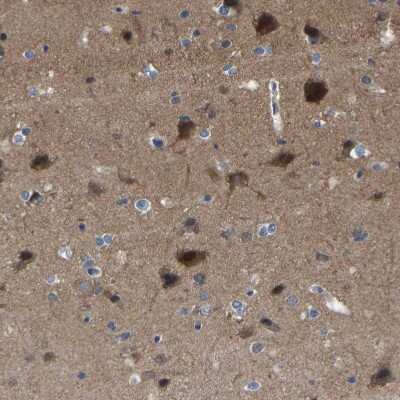 Immunohistochemistry-Paraffin: Citron Kinase Antibody [NBP1-88050]