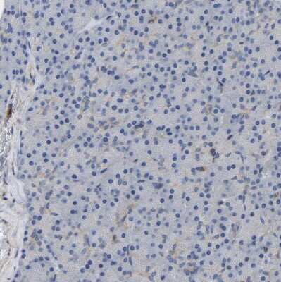 Immunohistochemistry-Paraffin: Citron Kinase Antibody [NBP1-88050]