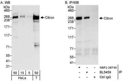 Immunoprecipitation: Citron Kinase Antibody [NBP1-28740]