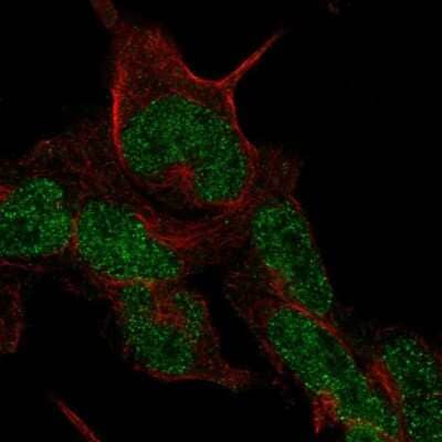 Immunocytochemistry/ Immunofluorescence: Cklfsf8 Antibody [NBP2-57893]