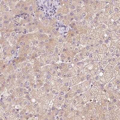 Immunohistochemistry: Cklfsf8 Antibody [NBP2-31594]