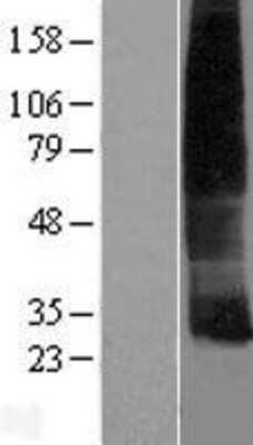 Western Blot: Cklfsf8 Overexpression Lysate [NBP2-04940]