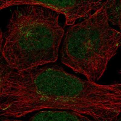 Immunocytochemistry/ Immunofluorescence: Claspin Antibody [NBP2-55291]