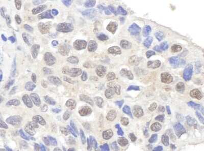 Immunohistochemistry-Paraffin: Claspin Antibody [NB100-247]